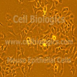 CFTR Knockout Mouse Cells (0)